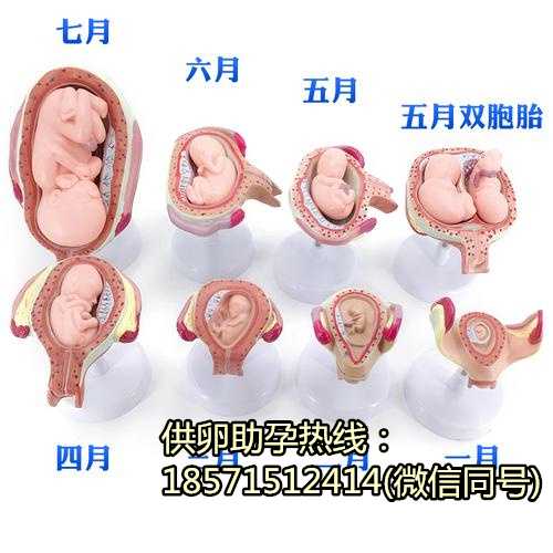 天津专业代孕电话23周做四维发现宫腔粘连带